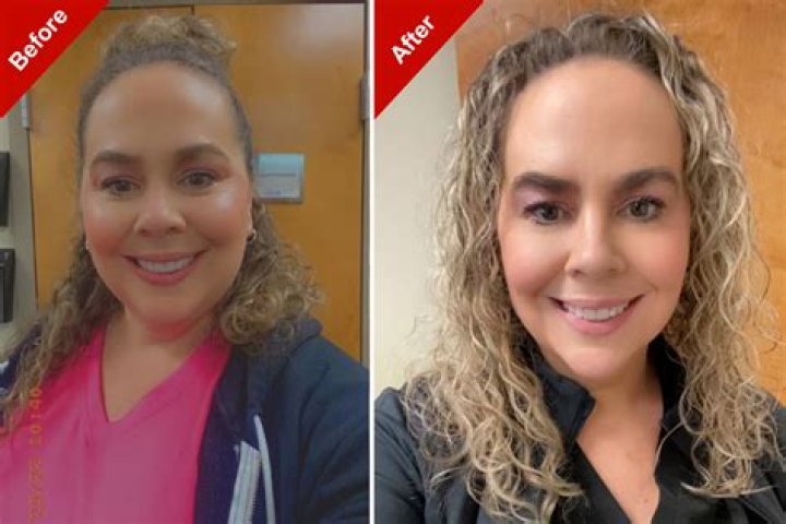 Amy Schneider Weight Loss After Surgery – Before And After Picture And Health Update