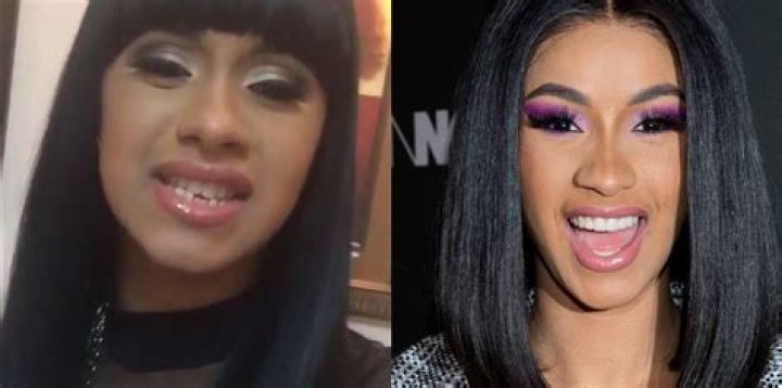 Cardi B's Teeth Transformation A Complete Breakdown