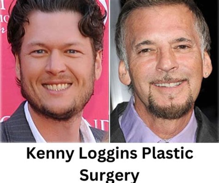 Has Kenny Loggins Had Plastic Surgery? Married Life And His Wives Details ·
