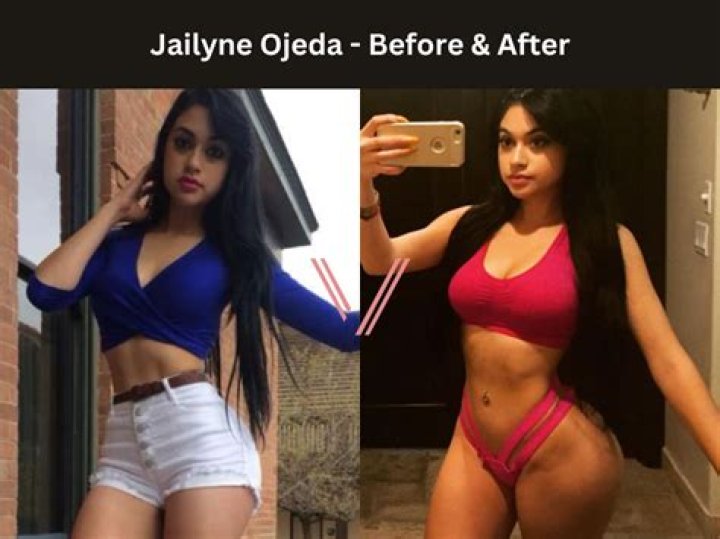 Jailyne Ojeda's Before And After BBL Journey