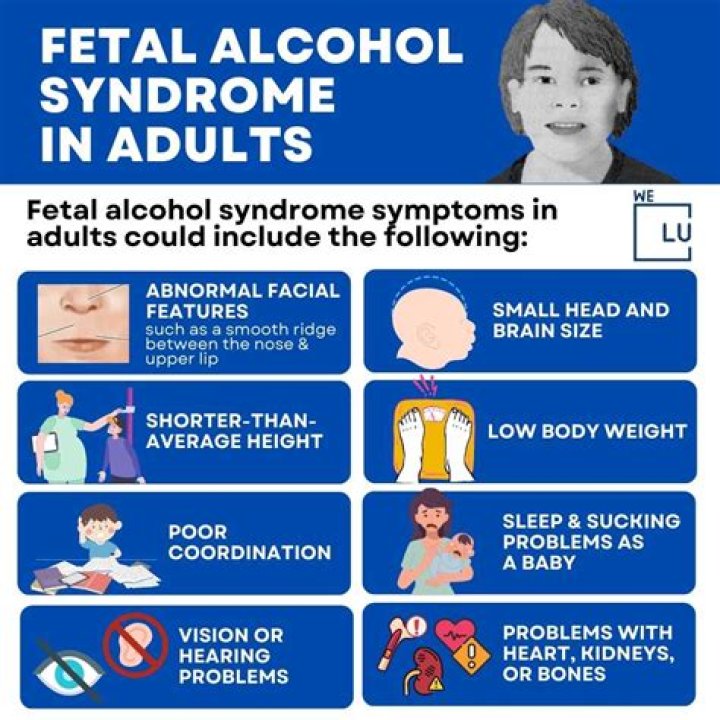Unraveling The Complexities Of Fetal Alcohol Syndrome