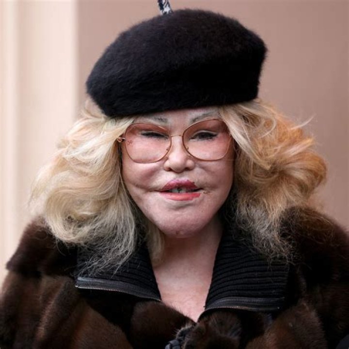 Unveiling The Enigmatic Jocelyn Wildenstein: Uncovering Secrets And Surprises